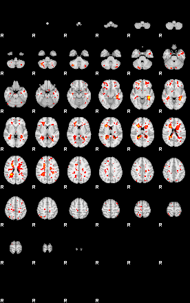 Patient:31;component:45