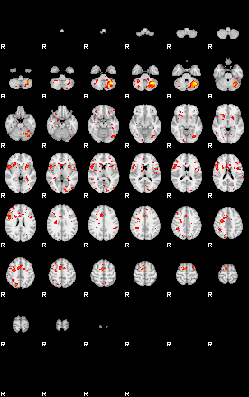 Patient:31;component:46