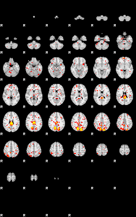 Patient:31;component:49