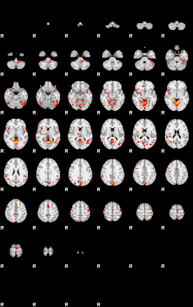 Patient:31;component:51