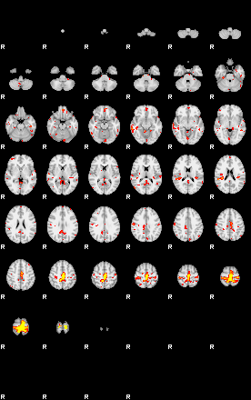 Patient:31;component:55