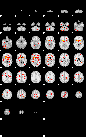 Patient:32;component:112