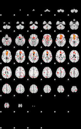 Patient:32;component:125