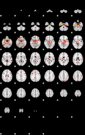 Patient:32;component:139