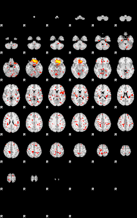 Patient:32;component:144