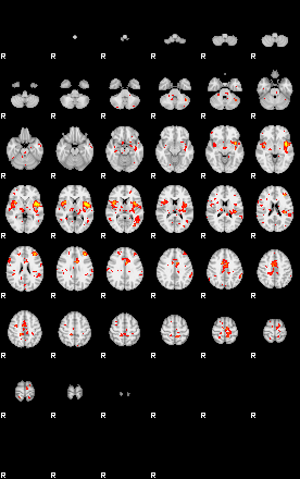 Patient:32;component:15