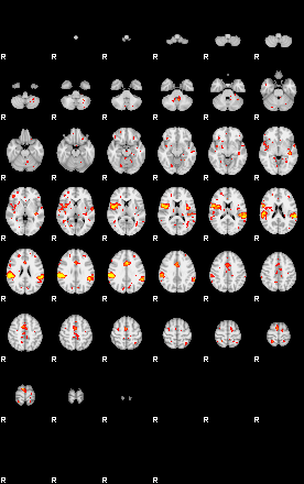 Patient:32;component:150