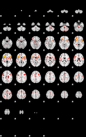 Patient:32;component:151