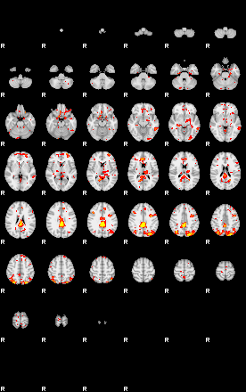 Patient:32;component:180