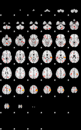 Patient:32;component:21