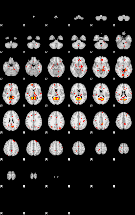 Patient:32;component:29