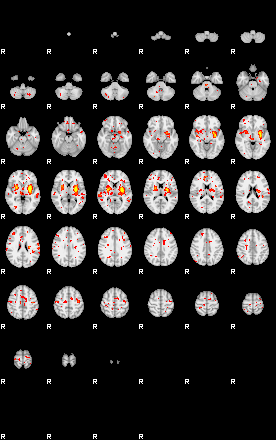 Patient:32;component:39