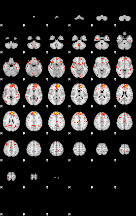 Patient:32;component:44