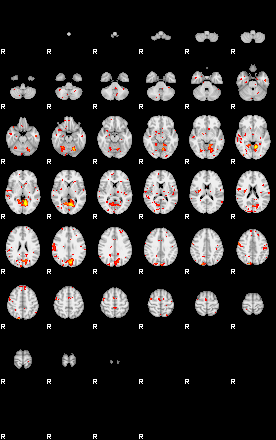 Patient:32;component:5