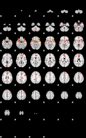 Patient:32;component:52