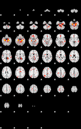 Patient:32;component:59