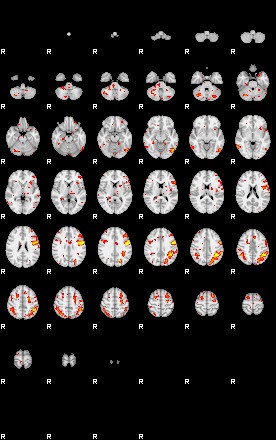 Patient:32;component:60