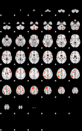 Patient:32;component:75