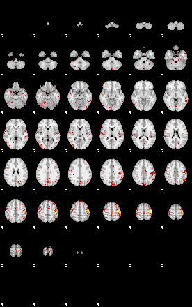 Patient:33;component:101