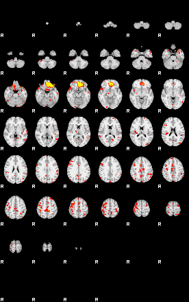 Patient:33;component:113