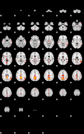 Patient:33;component:118