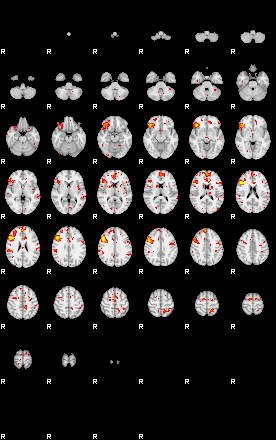 Patient:33;component:119