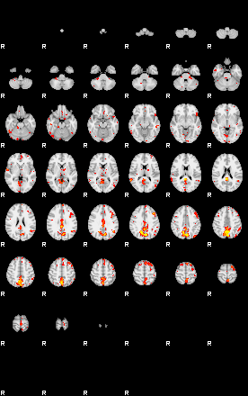 Patient:33;component:131