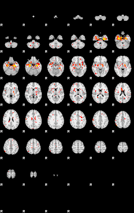 Patient:33;component:139