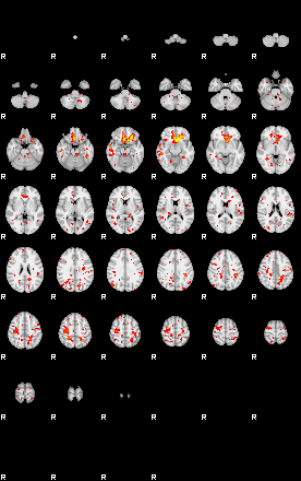 Patient:33;component:144