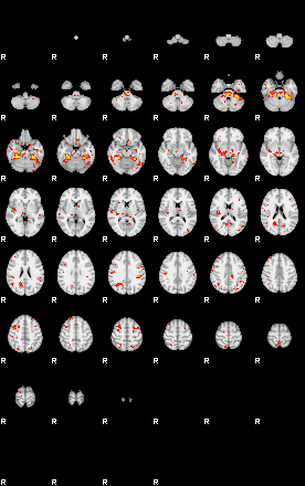 Patient:33;component:145