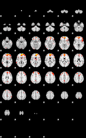 Patient:33;component:149