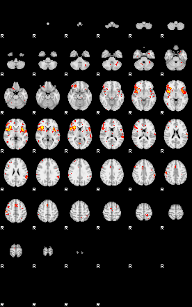 Patient:33;component:151