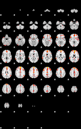 Patient:33;component:155