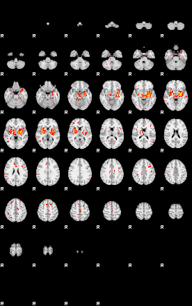 Patient:33;component:160