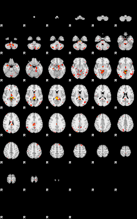 Patient:33;component:167