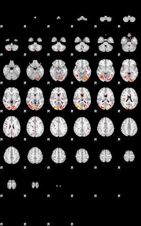 Patient:33;component:171