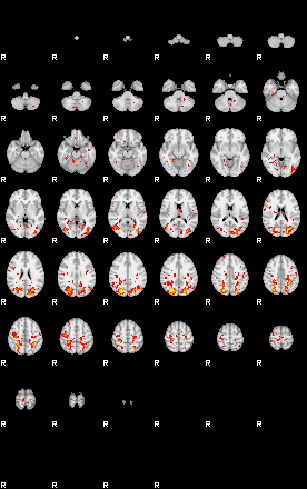 Patient:33;component:182