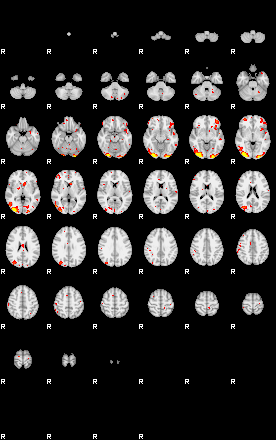 Patient:33;component:189