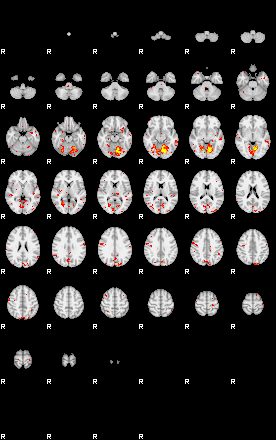 Patient:33;component:191