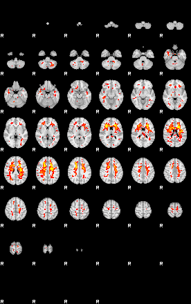 Patient:33;component:197