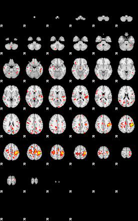 Patient:33;component:21