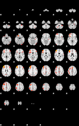 Patient:33;component:25