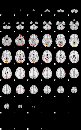 Patient:33;component:30