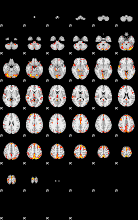 Patient:33;component:31