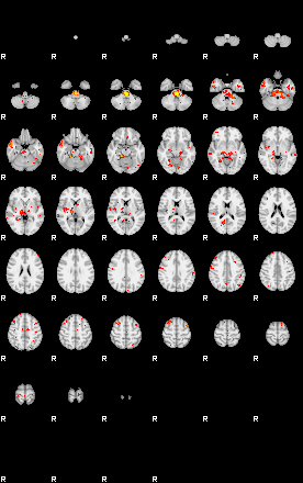 Patient:33;component:32