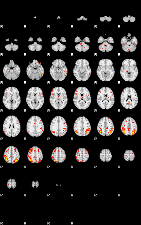 Patient:33;component:36