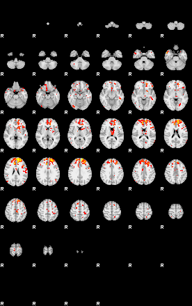 Patient:33;component:44