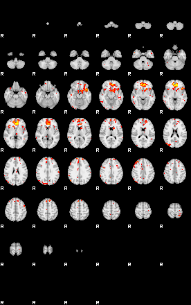 Patient:33;component:49