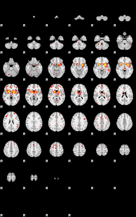 Patient:33;component:52