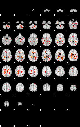 Patient:33;component:54